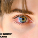 Its Eyes Are Bloodshot Pagalworld